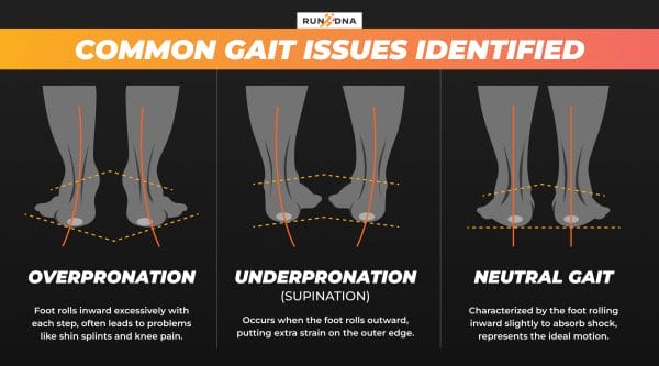 Diagram of common gait issues: overpronation, underpronation, and neutral gait, with visual foot illustrations.